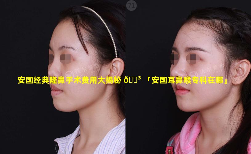 安国经典隆鼻手术费用大揭秘 🐳 「安国耳鼻喉专科在哪」